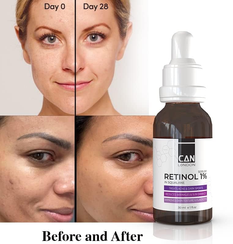 Retinol 1% Serum 30ml image 3