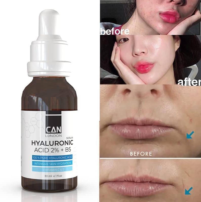 Serum for face Dark sport correction image 3